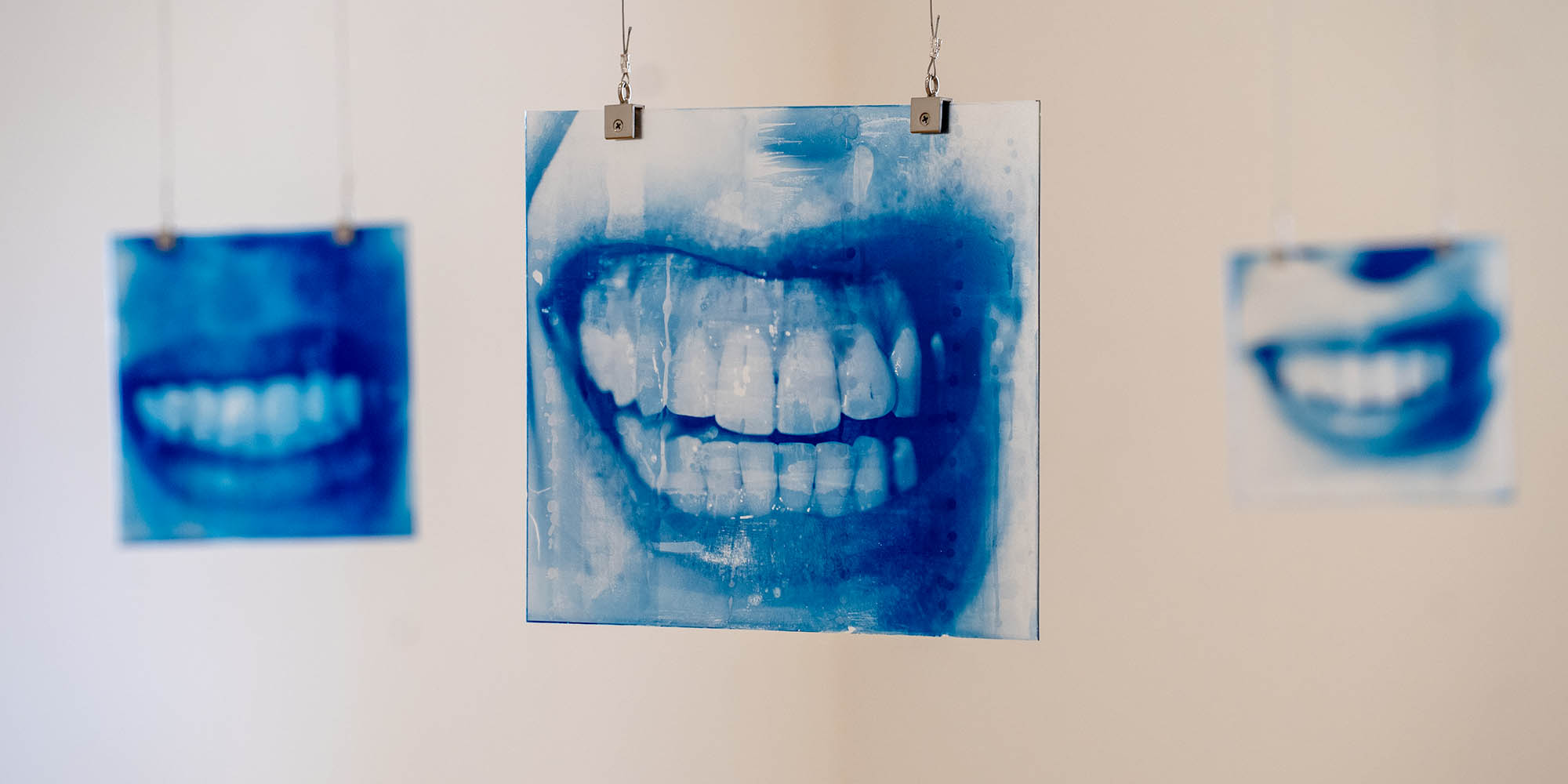 A series of three close up photos of teeth.